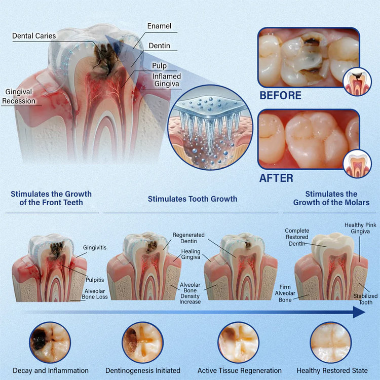 Restore Dentin