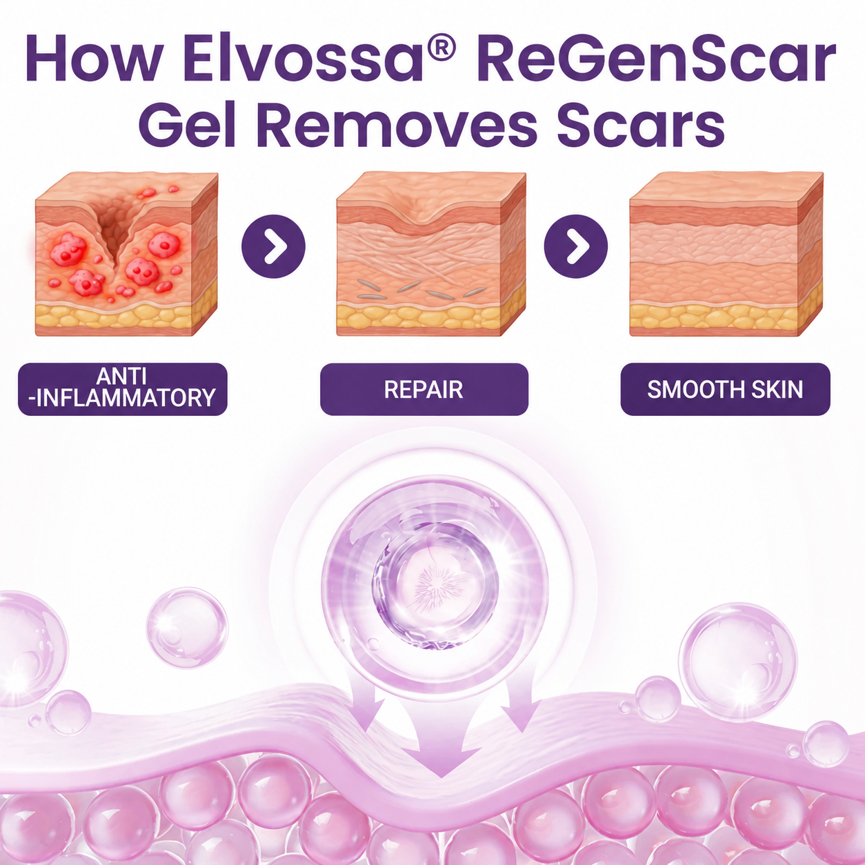 Elvossa® ReGenScar Stem Cell Scar Gel